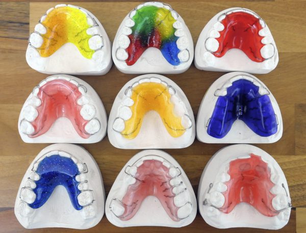 Plaatapparaten Orthodontiepraktijk Leeuwarden in kleuren.