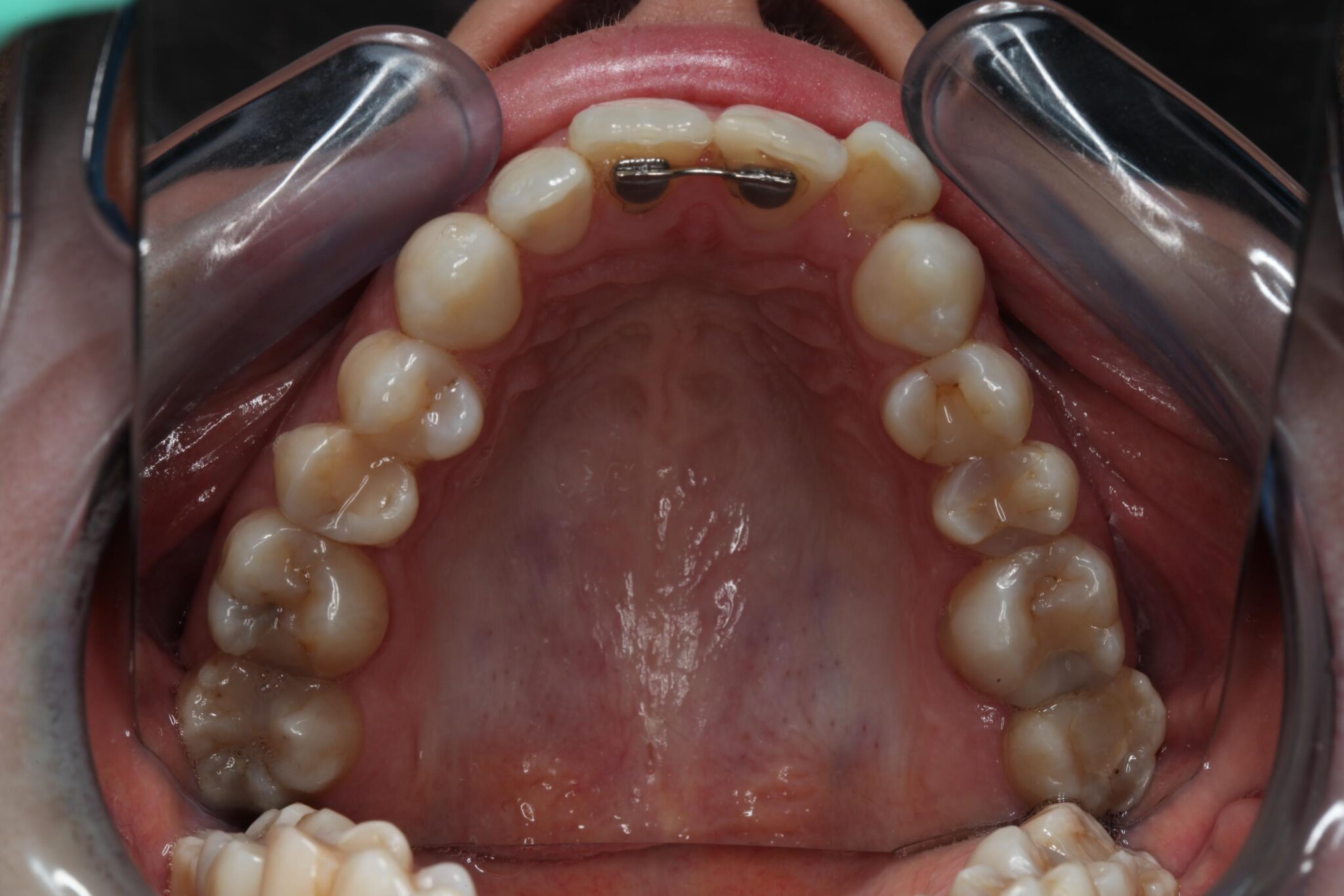 Orthodontiepraktijk Leeuwarden Spalkje - Orthodontiepraktijk Leeuwarden