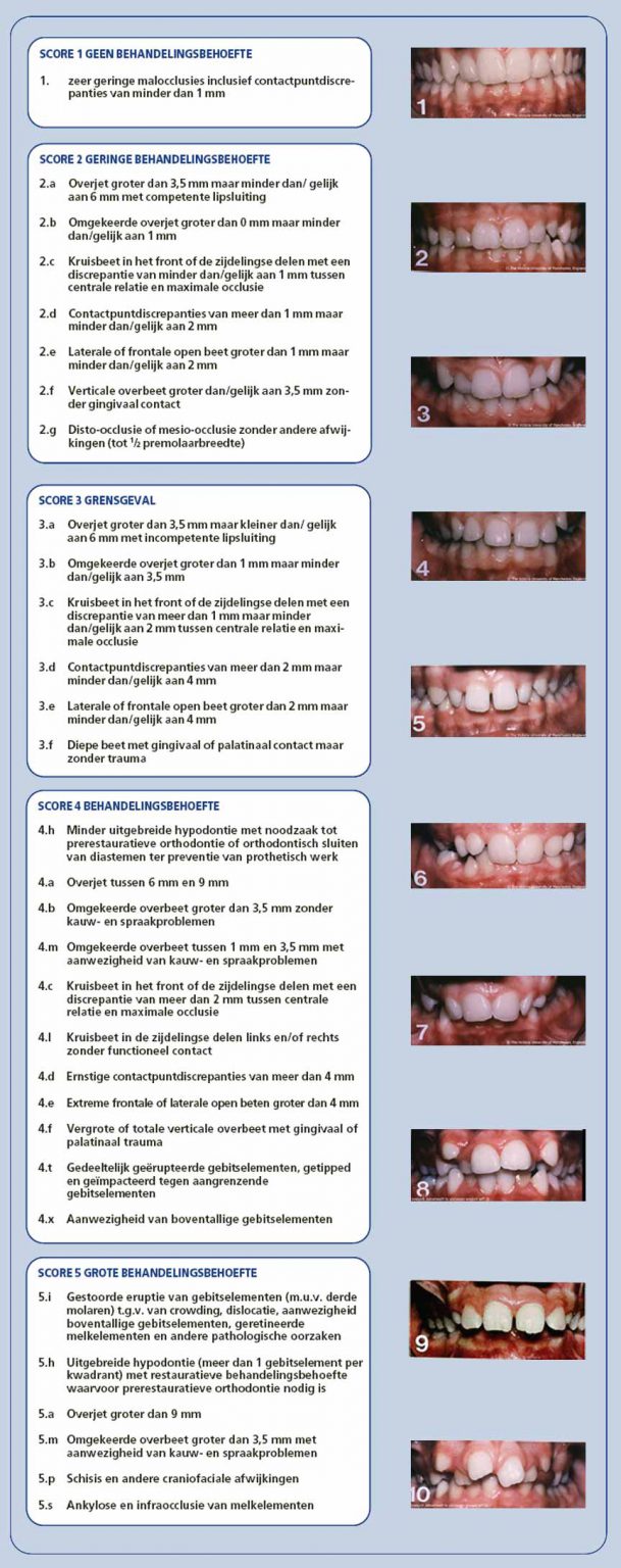 orthodontiepraktijk-leeuwarden-wat-vergoedt-mijn-verzekering